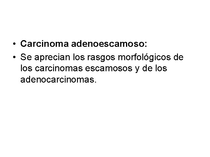  • Carcinoma adenoescamoso: • Se aprecian los rasgos morfológicos de los carcinomas escamosos
