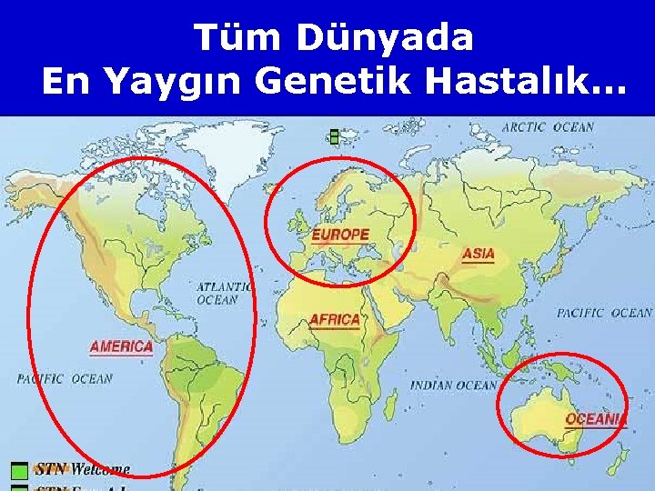 Tüm Dünyada En Yaygın Genetik Hastalık… 