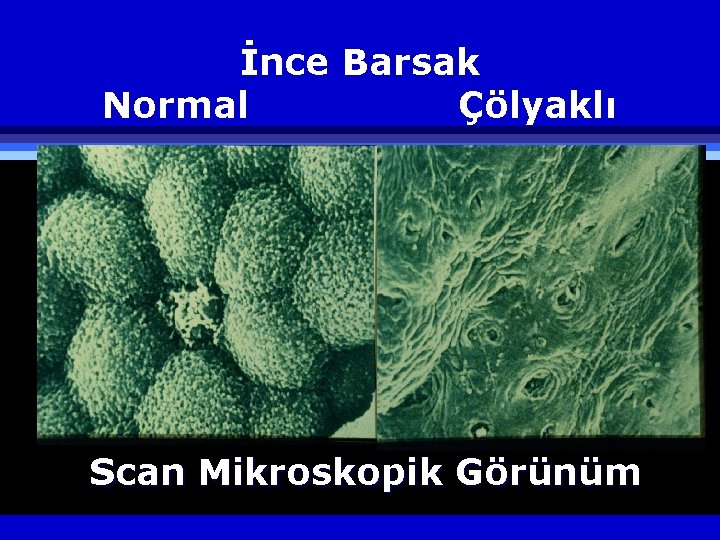 İnce Barsak Normal Çölyaklı Scan Mikroskopik Görünüm 