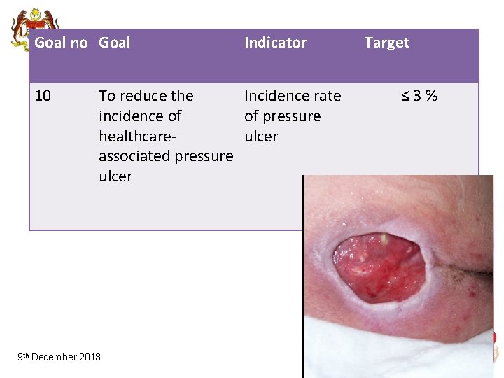 Goal no Goal 10 Indicator To reduce the Incidence rate incidence of of pressure