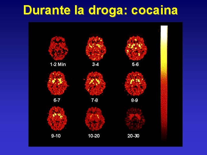 Durante la droga: cocaina 1 -2 Min 3 -4 5 -6 6 -7 7