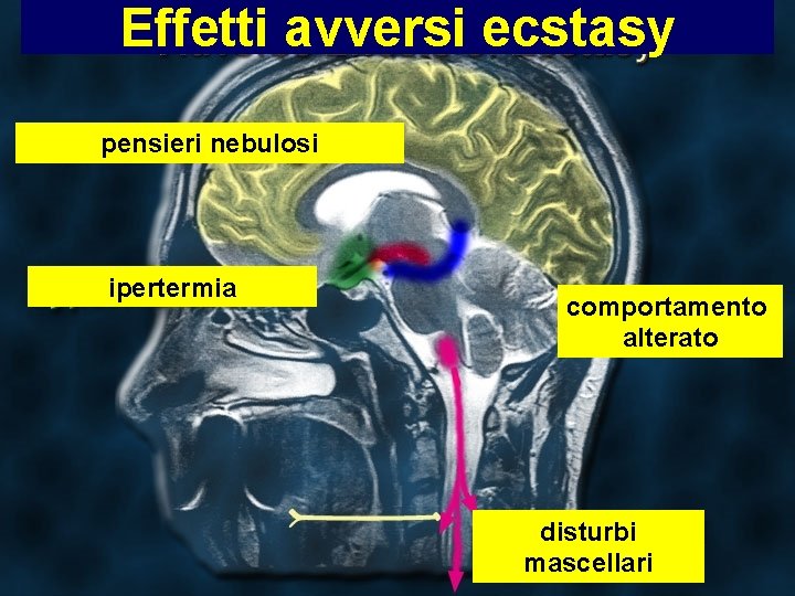 Effetti avversi ecstasy pensieri nebulosi ipertermia comportamento alterato disturbi mascellari 