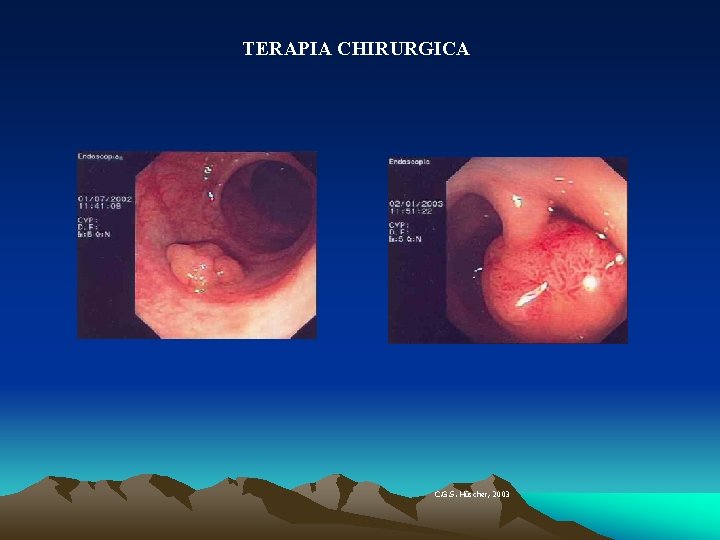 TERAPIA CHIRURGICA C. G. S. Hü Hüscher, 2003 