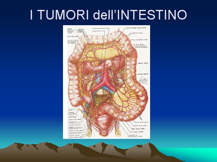 I TUMORI dell’INTESTINO 