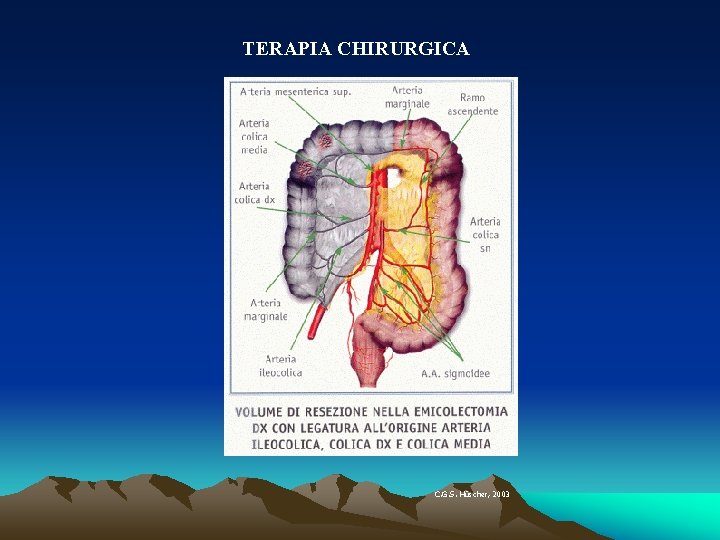 TERAPIA CHIRURGICA C. G. S. Hü Hüscher, 2003 