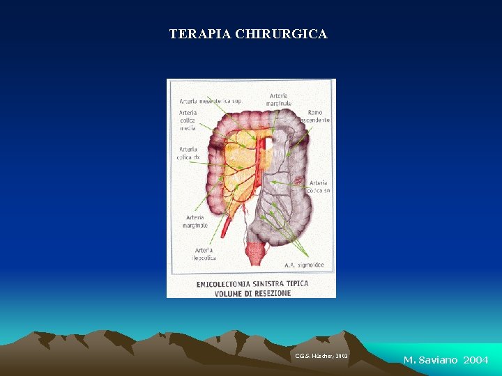 TERAPIA CHIRURGICA C. G. S. Hü Hüscher, 2003 M. Saviano 2004 