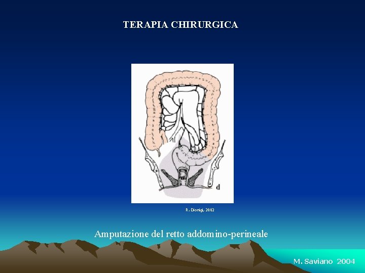 TERAPIA CHIRURGICA R. Dionigi, 2002 Amputazione del retto addomino-perineale M. Saviano 2004 