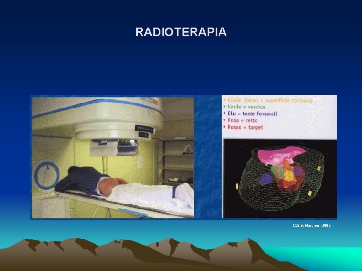 RADIOTERAPIA C. G. S. Hü Hüscher, 2003 