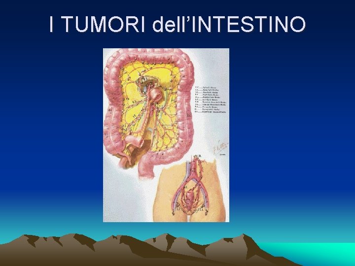 I TUMORI dell’INTESTINO 