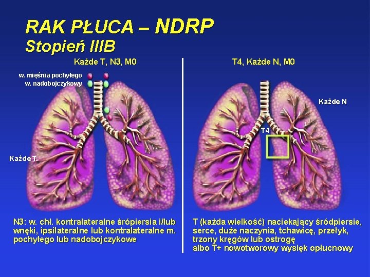 RAK PŁUCA – NDRP Stopień IIIB Każde T, N 3, M 0 T 4,