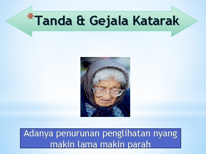 *Tanda & Gejala Katarak Adanya penurunan penglihatan nyang makin lama makin parah 