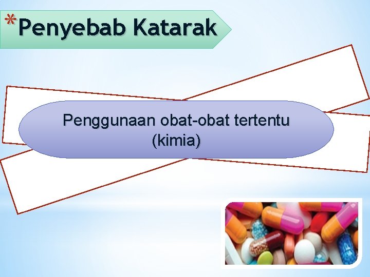 *Penyebab Katarak Penggunaan obat-obat tertentu (kimia) 