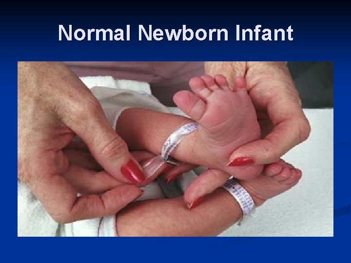 Normal Newborn Infant 