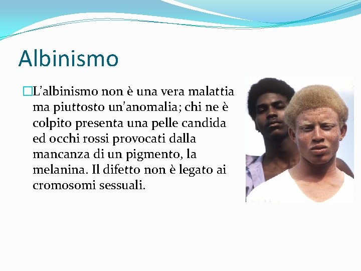 Albinismo �L’albinismo non è una vera malattia ma piuttosto un’anomalia; chi ne è colpito