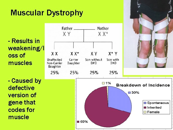 Muscular Dystrophy - Results in weakening/l oss of muscles - Caused by defective version