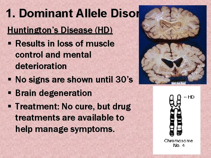 1. Dominant Allele Disorders Huntington’s Disease (HD) § Results in loss of muscle control