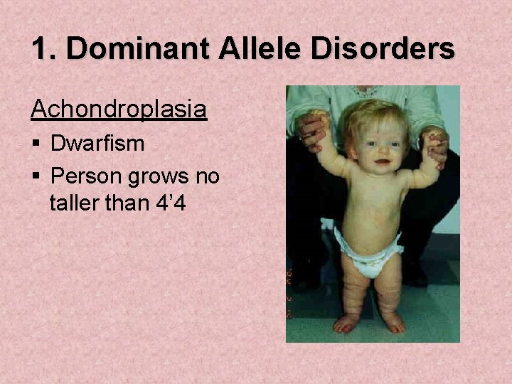 1. Dominant Allele Disorders Achondroplasia § Dwarfism § Person grows no taller than 4’