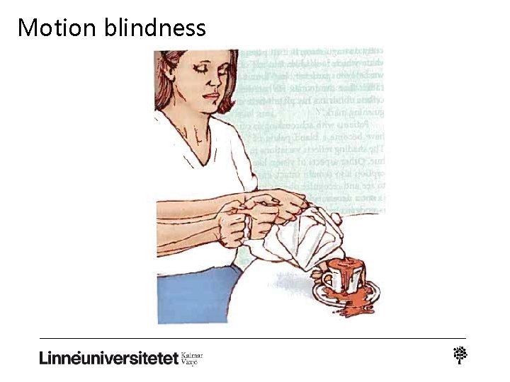 Motion blindness 