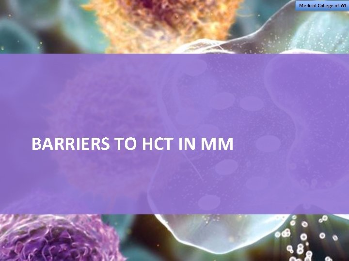 Medical College of WI BARRIERS TO HCT IN MM 