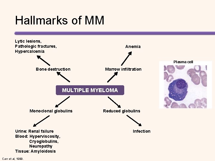 Hallmarks of MM Lytic lesions, Pathologic fractures, Hypercalcemia Anemia Plasma cell Bone destruction Marrow