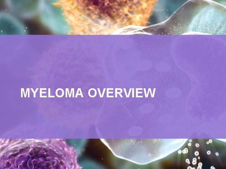 MYELOMA OVERVIEW 