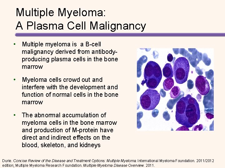 Multiple Myeloma: A Plasma Cell Malignancy • Multiple myeloma is a B-cell malignancy derived