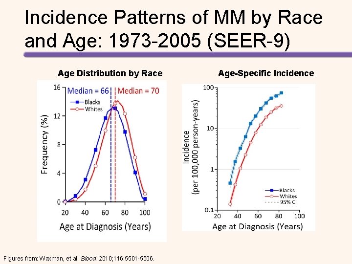 Incidence Patterns of MM by Race and Age: 1973 -2005 (SEER-9) Age Distribution by