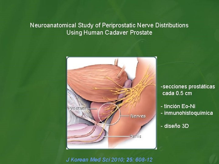 Neuroanatomical Study of Periprostatic Nerve Distributions Using Human Cadaver Prostate -secciones prostáticas cada 0.