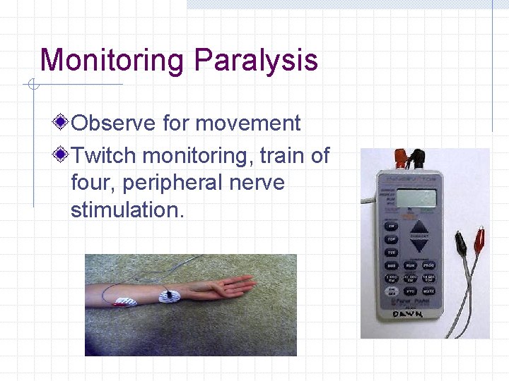 Monitoring Paralysis Observe for movement Twitch monitoring, train of four, peripheral nerve stimulation. Monitoring Paralysis Observe for movement Twitch monitoring, train of four, peripheral nerve stimulation.