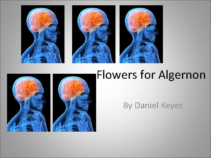 Flowers for Algernon By Daniel Keyes 