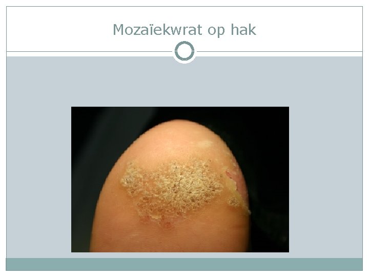 Mozaïekwrat op hak 