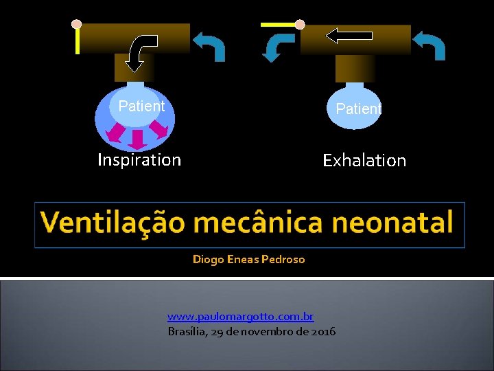 Patient Inspiration Exhalation Diogo Eneas Pedroso www. paulomargotto. com. br Brasília, 29 de novembro
