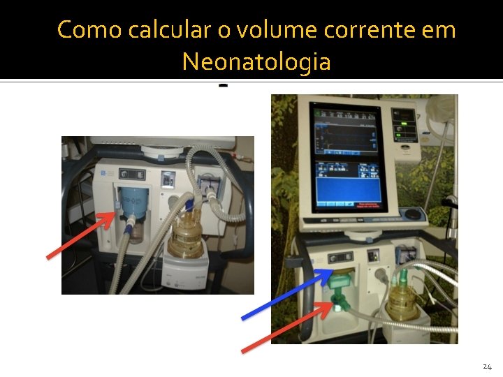 Como calcular o volume corrente em Neonatologia 24 