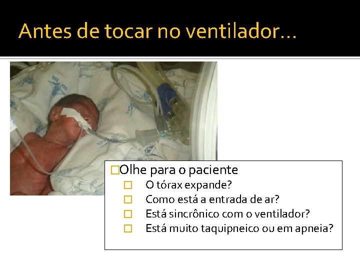 Antes de tocar no ventilador… �Olhe para o paciente � O tórax expande? �