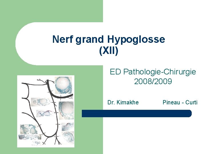 Nerf grand Hypoglosse (XII) ED Pathologie-Chirurgie 2008/2009 Dr. Kimakhe Pineau - Curti 