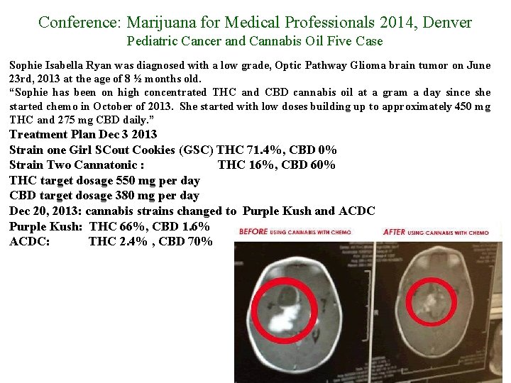 Conference: Marijuana for Medical Professionals 2014, Denver Pediatric Cancer and Cannabis Oil Five Case