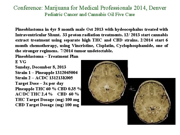 Conference: Marijuana for Medical Professionals 2014, Denver Pediatric Cancer and Cannabis Oil Five Case