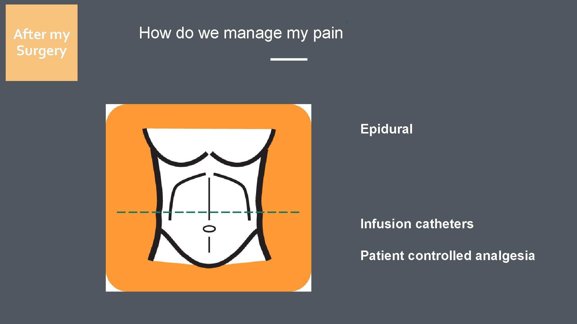 After my Surgery How do we manage my pain ’ Epidural Infusion catheters Patient