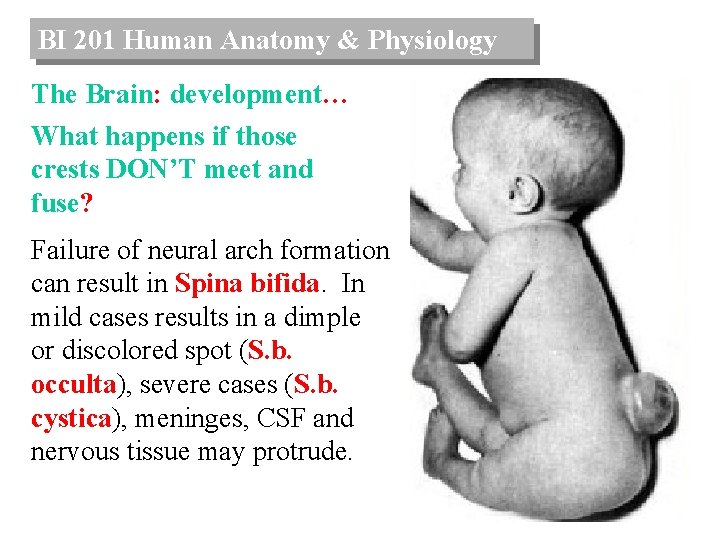 BI 201 Human Anatomy & Physiology The Brain: development… What happens if those crests