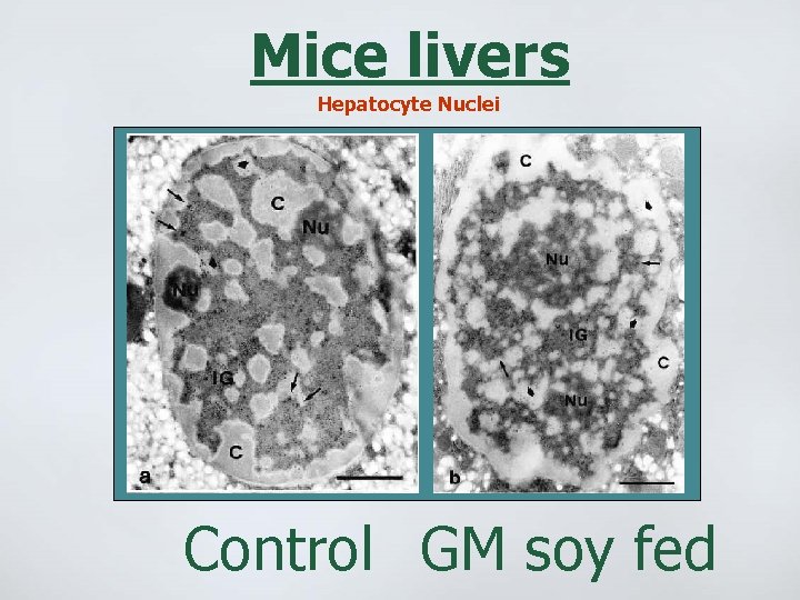 Mice livers Hepatocyte Nuclei Control GM soy fed 