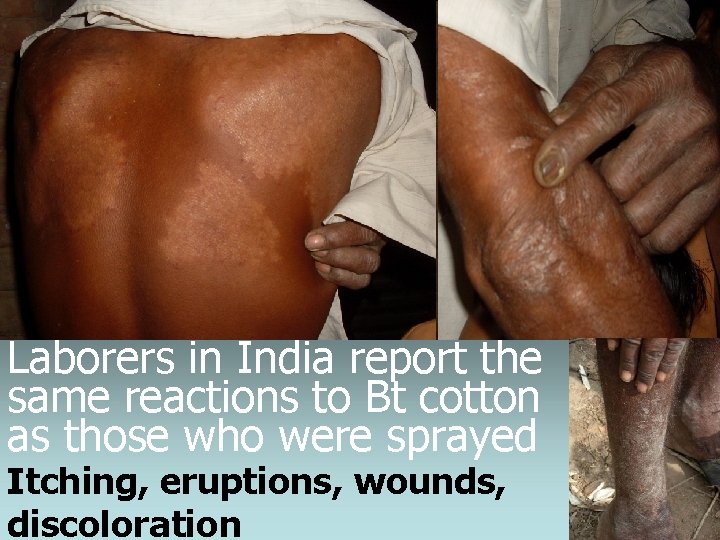 Laborers in India report the same reactions to Bt cotton as those who were