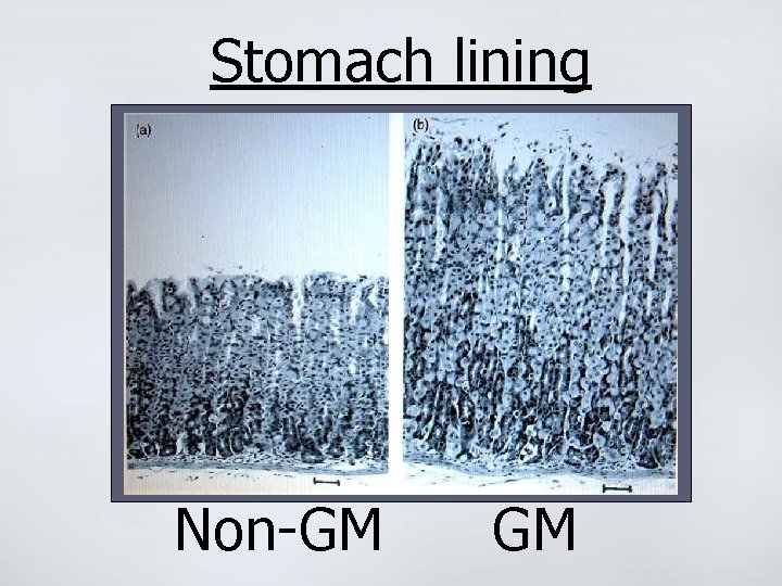 Stomach lining Non-GM GM 