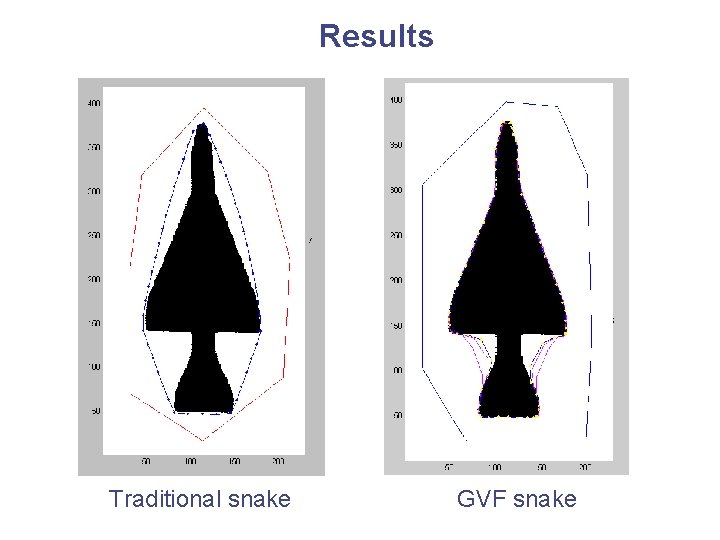 Results Traditional snake GVF snake Results Traditional snake GVF snake
