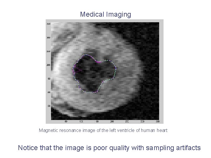 Medical Imaging Magnetic resonance image of the left ventricle of human heart Notice that Medical Imaging Magnetic resonance image of the left ventricle of human heart Notice that