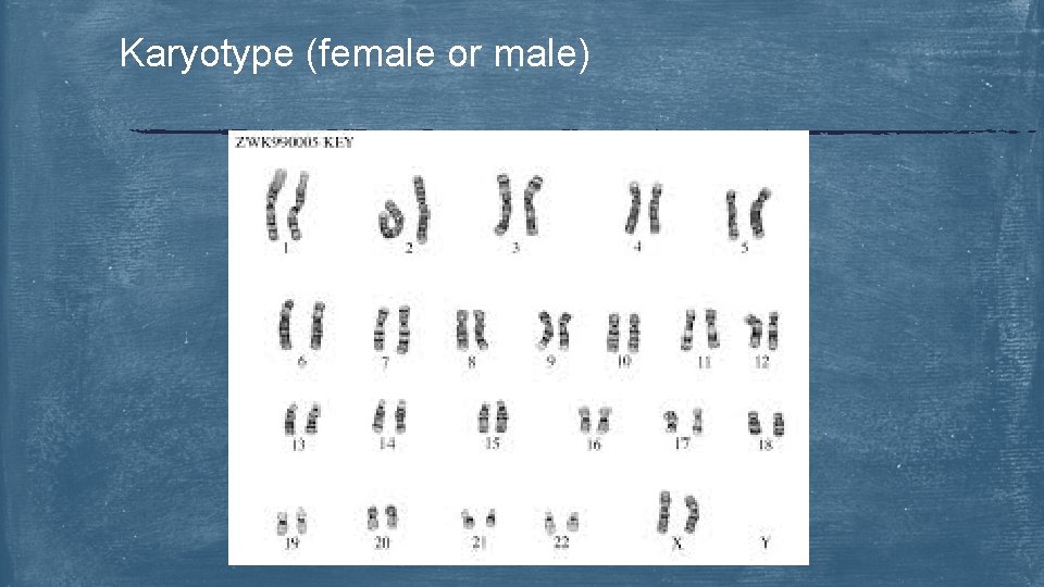 Karyotype (female or male) 