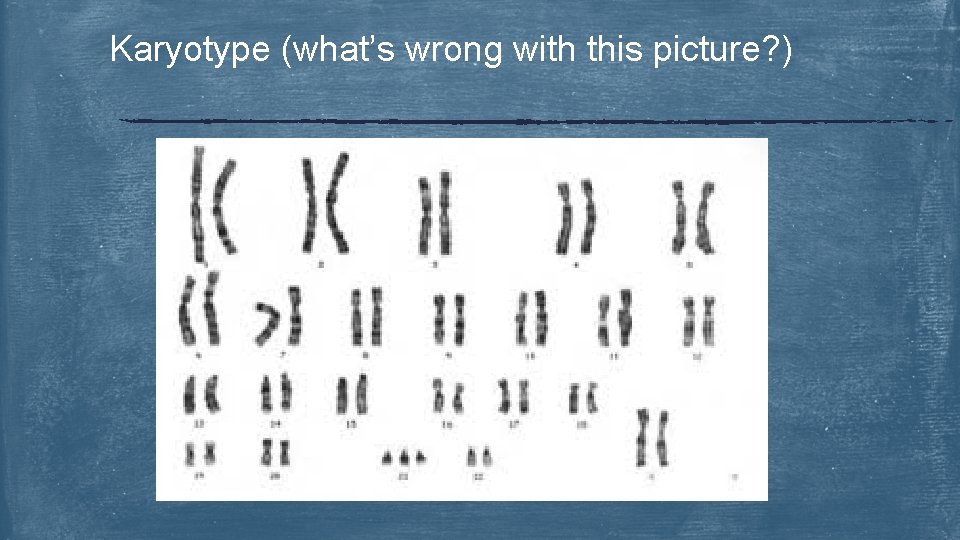 Karyotype (what’s wrong with this picture? ) 