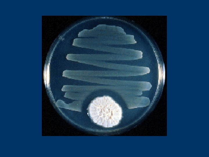 In 1928 Alexander Fleming noticed that the bacteria in a petri dish did not