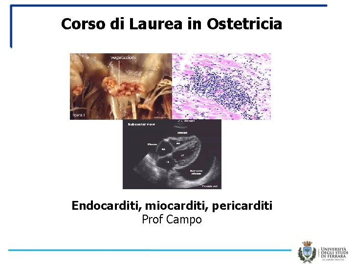 Corso di Laurea in Ostetricia Endocarditi, miocarditi, pericarditi Prof Campo 