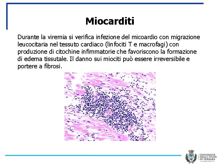 Miocarditi Durante la viremia si verifica infezione del micoardio con migrazione leucocitaria nel tessuto