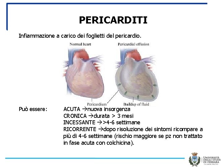 PERICARDITI Infiammazione a carico dei foglietti del pericardio. Può essere: ACUTA nuova insorgenza CRONICA